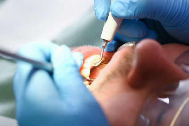 Best Emergency Treatment for Toothache in Frankfort, OH